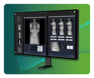 Bone Metrics